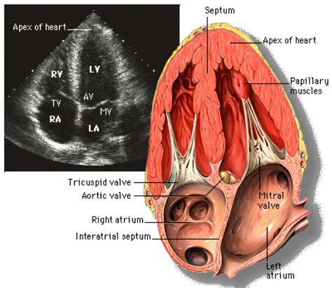 echocardiogram heart valve.